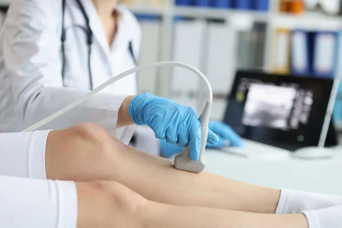 Ultrassom Vascular